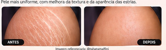 Antes e depois de referência